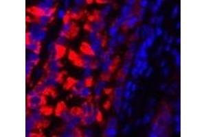 Immunofluorescence analysis of Rat lung tissue using MMP2 Polyclonal Antibody at dilution of 1:200. (MMP2 抗体)