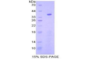 SDS-PAGE analysis of Mouse GSK3a Protein. (GSK3 alpha 蛋白)