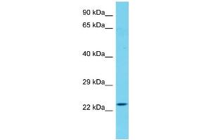Host: Rabbit Target Name: CXorf56 Sample Type: Fetal Heart lysates Antibody Dilution: 1. (CXorf56 抗体  (C-Term))
