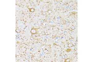 Immunohistochemistry of paraffin-embedded mouse brain using βIII-Tubulin/β3-Tubulin  at dilution of 100 (40x lens). (TUBB3 抗体)