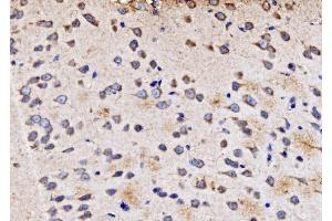 IHC analysis of PMPCA/INPP5 using anti-PMPCA/INPP5 antibody (ABIN7602722). (PMPCA 抗体  (AA 99-525))