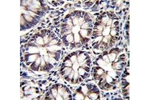 CTBP2 antibody immunohistochemistry analysis in formalin fixed and paraffin embedded human rectum tissue. (CTBP2 抗体  (AA 1-30))