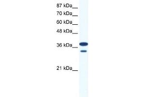 Human Jurkat; WB Suggested Anti-LHX3 Antibody Titration: 0. (LHX3 抗体  (Middle Region))