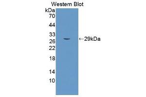 Western blot analysis of the recombinant protein. (PSMA 抗体  (AA 536-752))