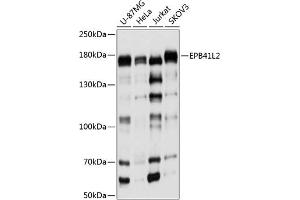 Western blot analysis of extracts of various cell lines, using EPB41L2 antibody (ABIN6131606, ABIN6140199, ABIN6140200 and ABIN6224888) at 1:1000 dilution. (EPB41L2 抗体  (AA 1-210))