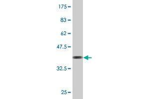 Western Blotting (WB) image for anti-Transmembrane Protein with EGF-Like and Two Follistatin-Like Domains 2 (TMEFF2) (AA 201-292) antibody (ABIN525362)