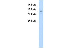 WB Suggested Anti-C20orf18 Antibody Titration:  1. (RBCK1 抗体  (Middle Region))