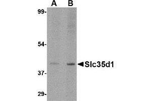 Western Blotting (WB) image for anti-Solute Carrier Family 35 (UDP-Glucuronic Acid/UDP-N-Acetylgalactosamine Dual Transporter), Member D1 (SLC35D1) (N-Term) antibody (ABIN1031577) (SLC35D1 抗体  (N-Term))