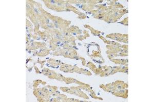 Immunohistochemistry of paraffin-embedded mouse heart using UCN2 antibody (ABIN5973879) at dilution of 1/100 (40x lens). (Urocortin 2 抗体)