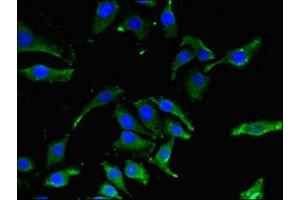 Immunofluorescent analysis of A549 cells using ABIN7146741 at dilution of 1:100 and Alexa Fluor 488-congugated AffiniPure Goat Anti-Rabbit IgG(H+L) (CBR1 抗体  (AA 176-268))