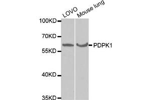 Western blot analysis of extracts of various cell lines, using PDPK1 antibody (ABIN5970826) at 1/1000 dilution. (PDPK1 抗体)