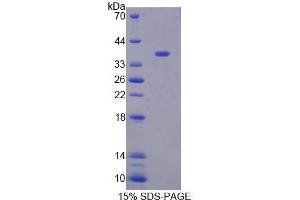 SDS-PAGE analysis of Human XRN1 Protein. (XRN1 蛋白)