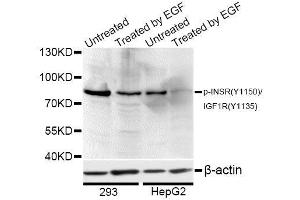Western blot analysis of extracts of 293 and HepG2 cells, using Phospho-INSR-Y1150/IGF1R-Y1135 antibody (ABIN5969901) at 1/1000 dilution. (Insulin Receptor 抗体  (pTyr1135, pTyr1150))
