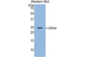 Western Blotting (WB) image for anti-Fibulin 2 (FBLN2) (AA 1013-1221) antibody (ABIN1858811) (FBLN2 抗体  (AA 1013-1221))