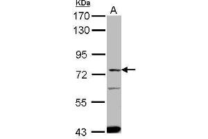 WB Image Sample (30 ug of whole cell lysate) A: HepG2 7. (SLC27A4 抗体  (Center))