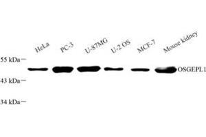 Western blot analysis of OSGEPL1 (ABIN7074934) at dilution of 1: 2000 (OSGEPL1 抗体)