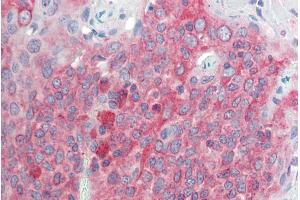ABIN571264 (5µg/ml) staining of paraffin embedded Human Tonsil. (TMEM205 抗体  (AA 137-146))