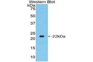 Western Blotting (WB) image for anti-Toll-Like Receptor 7 (TLR7) (AA 887-1036) antibody (ABIN1860776)