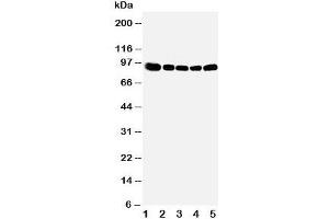 Western blot testing of OSBP antibody and Lane 1:  rat kidney;  2: (r) spleen;  3: (r) lung;  4: human HeLa;  5: (h) A549 cell lysate (OSBP 抗体  (Middle Region))