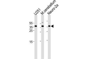 Western Blotting (WB) image for anti-Empty Spiracles Homeobox 1 (EMX1) antibody (ABIN3003987) (EMX1 抗体)