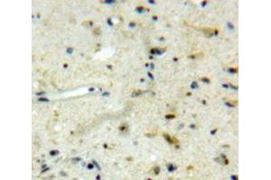 Used in DAB staining on fromalin fixed paraffin-embedded Brain tissue