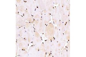 Immunohistochemistry (Paraffin-embedded Sections) (IHC (p)) image for anti-Zinc Finger and SCAN Domain Containing 25 (ZSCAN25) antibody (ABIN7076253)
