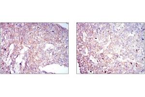 Immunohistochemistry (IHC) image for anti-Coactosin-Like Protein antibody (ABIN1106731) (COTL1 抗体)