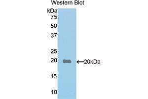 Western blot analysis of the recombinant protein. (PON1 抗体  (AA 187-354))