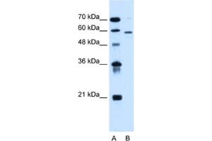 Western Blotting (WB) image for anti-Asparagine-Linked Glycosylation 11, alpha-1,2-Mannosyltransferase Homolog (Yeast) (ALG11) antibody (ABIN2462823) (ALG11 抗体)