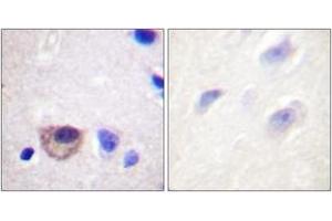 Immunohistochemistry analysis of paraffin-embedded human brain tissue, using ATPase (Ab-16) Antibody. (ATPase 抗体  (AA 5-54))