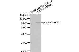 Western Blotting (WB) image for anti-V-Raf-1 Murine Leukemia Viral Oncogene Homolog 1 (RAF1) (pSer621) antibody (ABIN3019551) (RAF1 抗体  (pSer621))