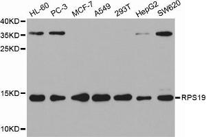 Western blot analysis of extracts of various cell lines, using RPS19 antibody. (RPS19 抗体  (AA 1-145))