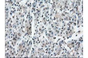 Image no. 19 for anti-P450 (Cytochrome) Oxidoreductase (POR) antibody (ABIN1497746) (POR 抗体)