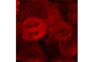 Immunofluorescence staining of methanol-fixed Hela cells using Phospho-MAP2K2-T394 antibody. (MEK2 抗体  (pThr394))