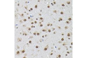 Immunohistochemistry (IHC) image for anti-Polypyrimidine Tract Binding Protein 2 (PTBP2) (AA 1-280) antibody (ABIN6146373)