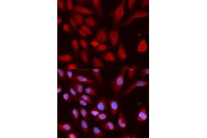Immunofluorescence analysis of U2OS cells using UHRF1 antibody (ABIN5971303). (UHRF1 抗体)