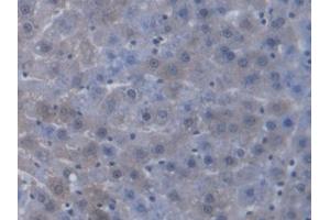 DAB staining on IHC-P; Samples: Rat Liver Tissue (TAP2 抗体  (AA 467-703))