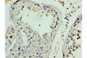 Immunohistochemistry of paraffin-embedded human testis tissue using ABIN7152879 at dilution of 1:100 (FANK1 抗体  (AA 1-345))