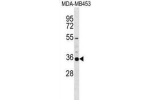 Western Blotting (WB) image for anti-Potassium Voltage-Gated Channel, Shaker-Related Subfamily, Member 5 (KCNA5) antibody (ABIN2999168) (KCNA5 抗体)