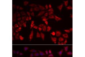Immunofluorescence analysis of MCF-7 cells using PYGL Polyclonal Antibody (PYGL 抗体)