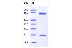 SDS-PAGE (SDS) image for Proprotein Convertase Subtilisin/kexin Type 9 (PCSK9) (AA 35-694) (Active) protein (His tag) (ABIN2181589)