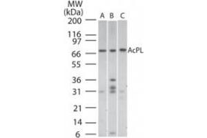 Image no. 1 for anti-Interleukin 18 Receptor Accessory Protein (IL18RAP) (AA 50-100) antibody (ABIN199977) (IL18RAP 抗体  (AA 50-100))