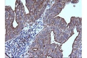 Image no. 3 for anti-Tripartite Motif Containing 38 (TRIM38) (AA 1-265) antibody (ABIN1490685)