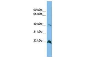 Image no. 1 for anti-TDP-Glucose 4,6-Dehydratase (TGDS) (AA 143-192) antibody (ABIN6745075) (TGDS 抗体  (AA 143-192))