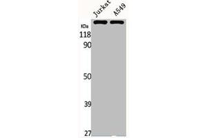 Western Blotting (WB) image for anti-ATP-Binding Cassette, Sub-Family C (CFTR/MRP), Member 1 (ABCC1) (Internal Region) antibody (ABIN7187381)