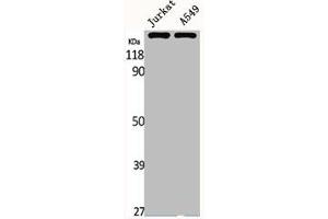 Western Blot analysis of Jurkat A549 cells using MRP7 Polyclonal Antibody (ABCC1 抗体  (Internal Region))
