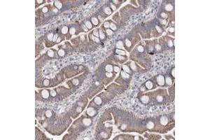 Immunohistochemical staining of human small intestine with MTCH2 polyclonal antibody  shows moderate cytoplasmic positivity in glandular cells.