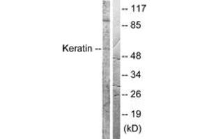 Western blot analysis of extracts from HeLa cells, treated with Anisomycin 25ug/ml 30', using Keratin 8 (Ab-73) Antibody. (KRT8 抗体  (AA 41-90))
