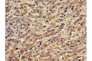 Immunohistochemistry (IHC) image for anti-ATP-Binding Cassette, Sub-Family A (ABC1), Member 5 (ABCA5) (AA 1230-1355) antibody (ABIN7144881)