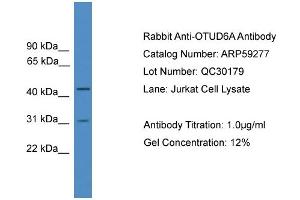 WB Suggested Anti-OTUD6A  Antibody Titration: 0. (OTUD6A 抗体  (Middle Region))